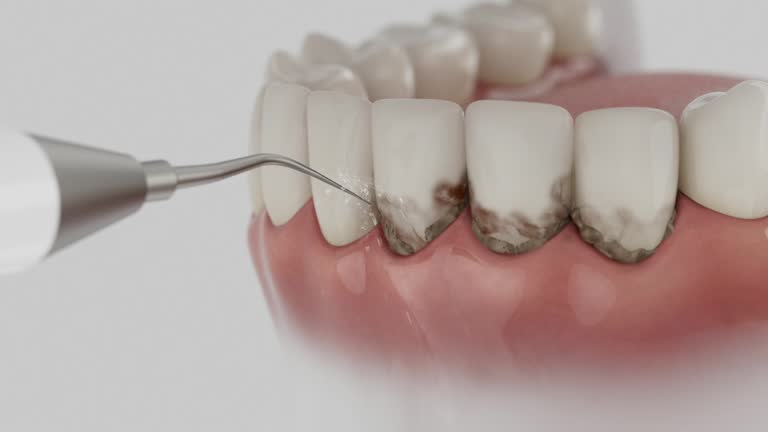 Reliable Dental Implants contractor in Pharr, TX by Smile Center Dentistry